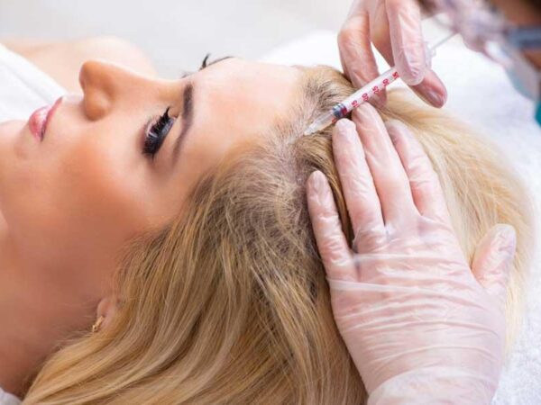 botox treatment